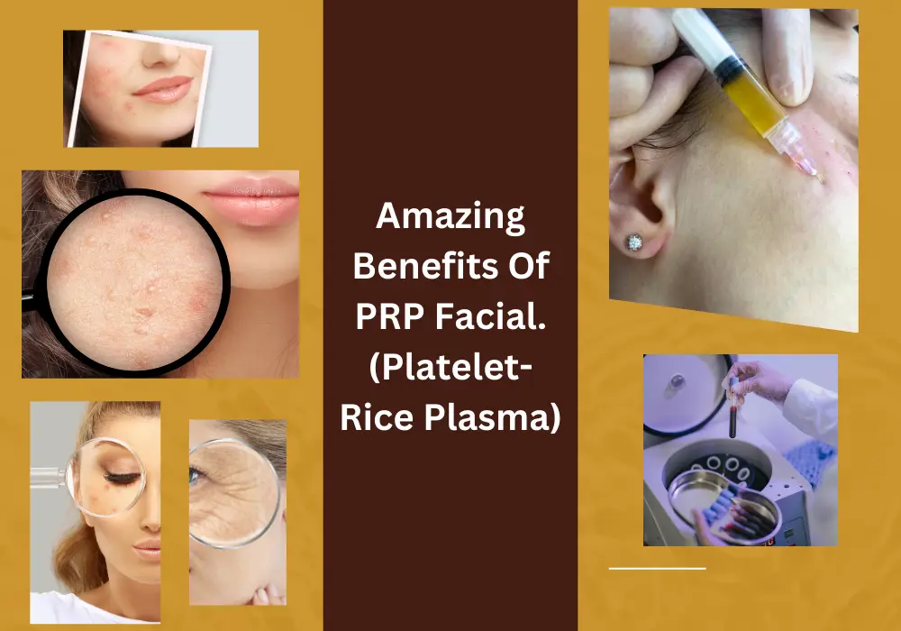 PRP facial benefits