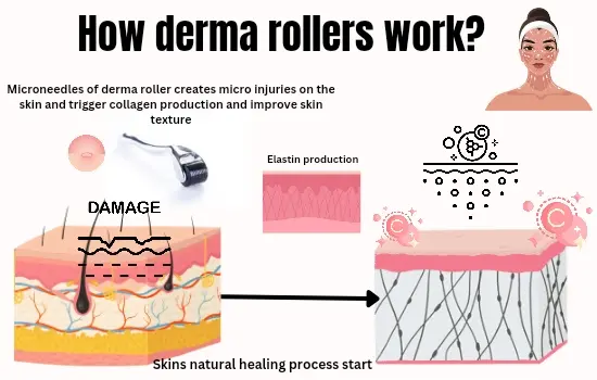 how derma rollers work