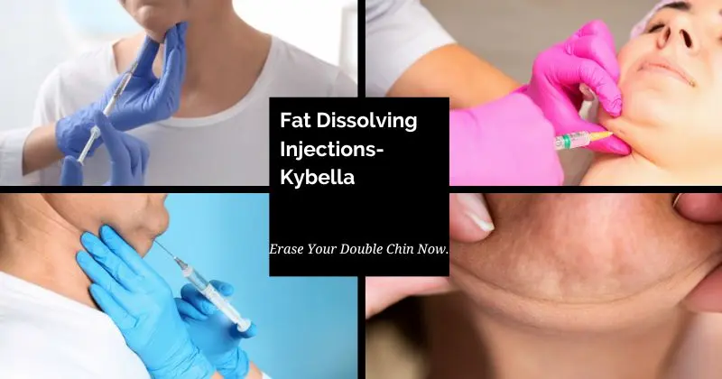 Fat Dissolving Injections-Kybella