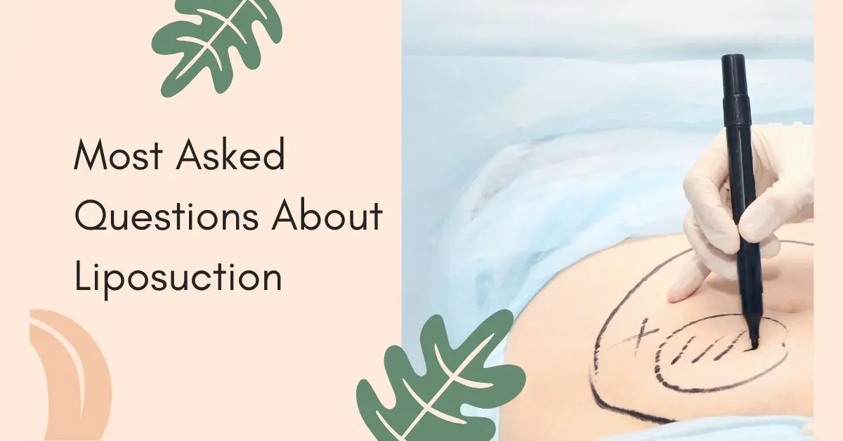 Frequently Asked Questions About Liposuction