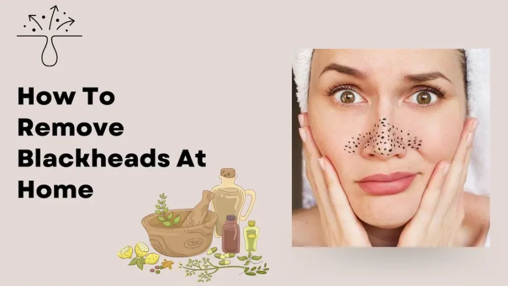 home remedies for black head removal