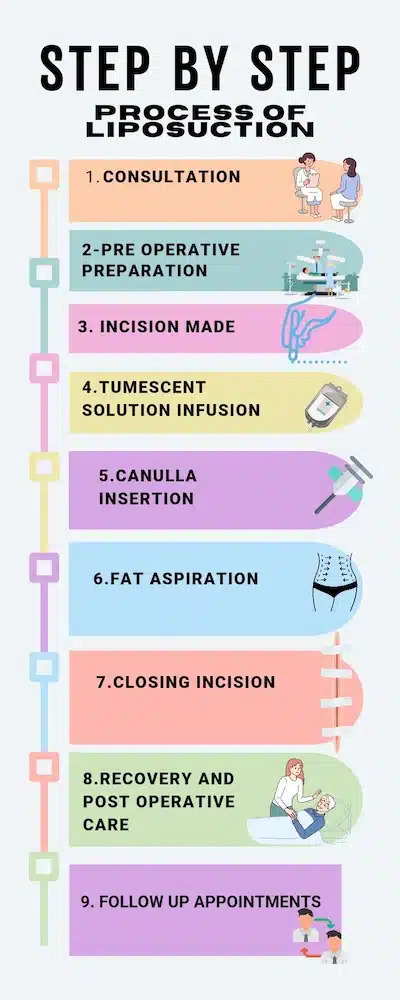 liposuction process