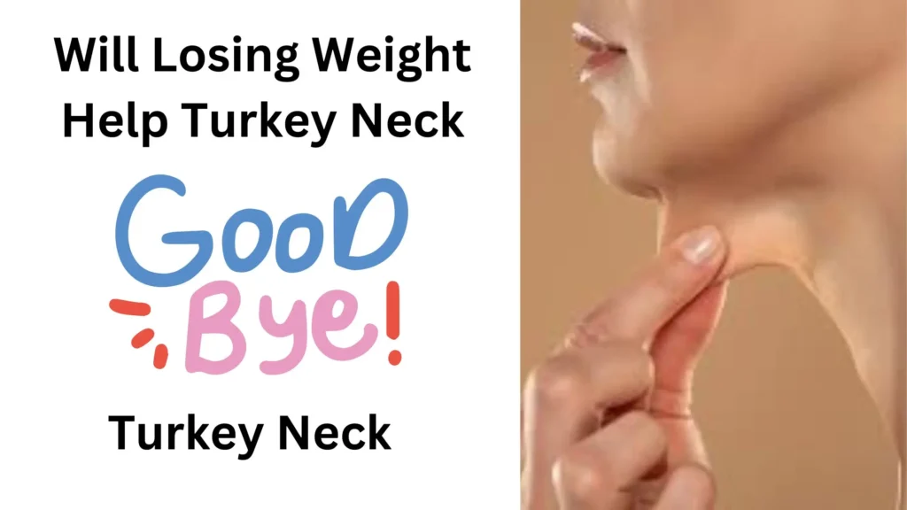 will losing weight help turkey neck
