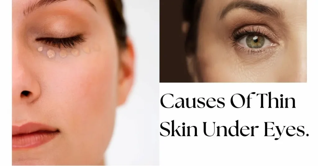 Causes Of Thin Skin Under Eyes!